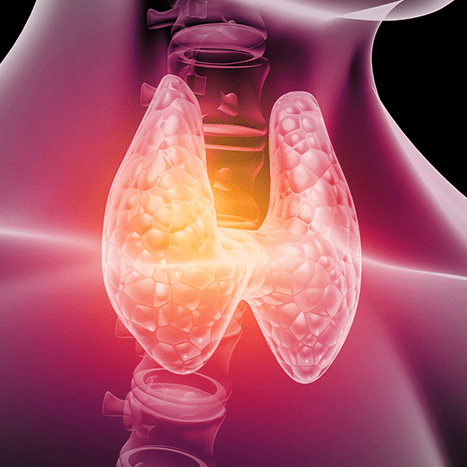 Doenças da Tireoide